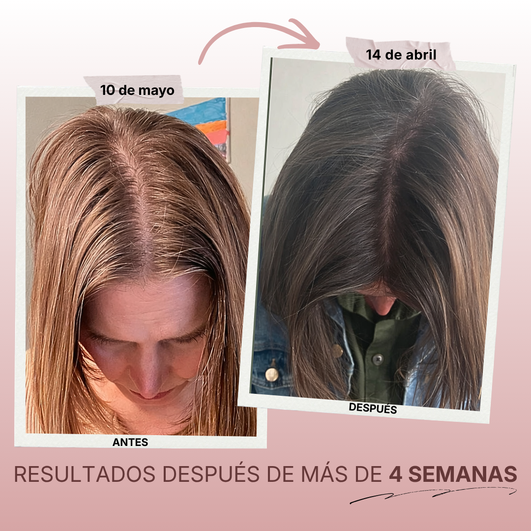Winalix™ – Aceite de crecimiento natural rápido