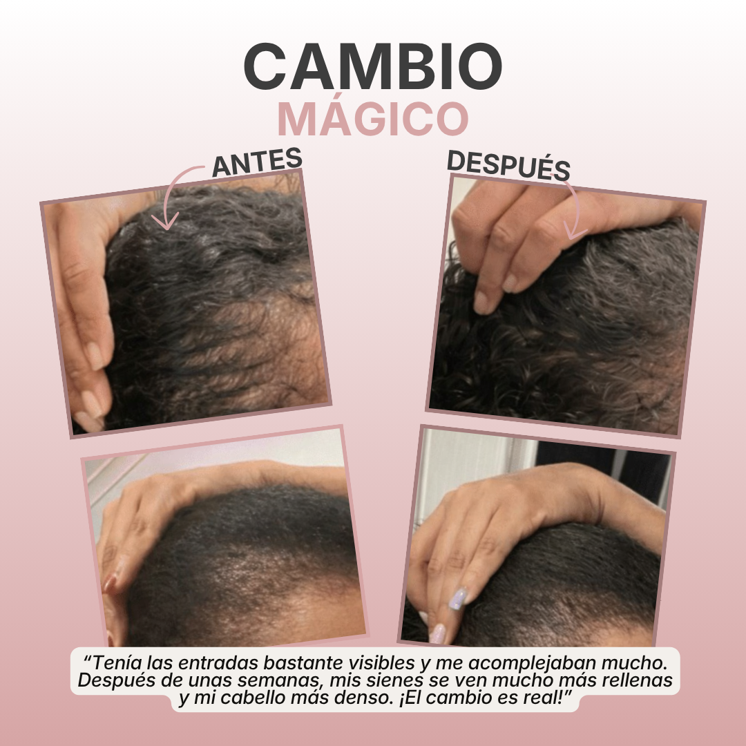 Winalix™ – Aceite de crecimiento natural rápido