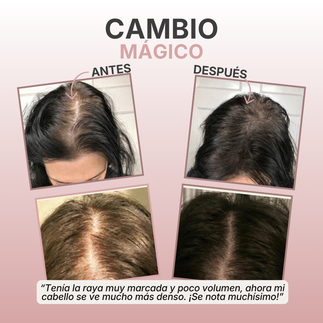 Winalix™ – Aceite de crecimiento natural rápido