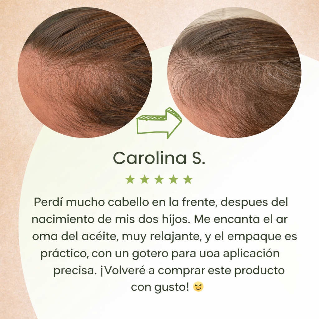 HairBoost™ – Sérum de Crecimiento Natural