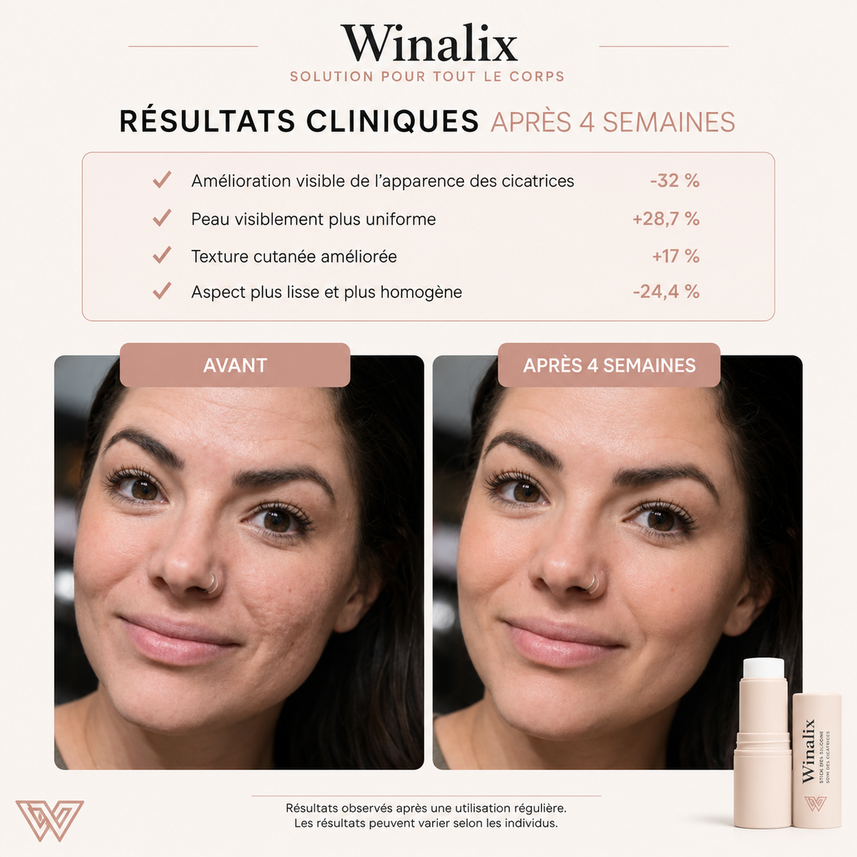 Winalix™ │Stick Silicone Anti-cicatrice